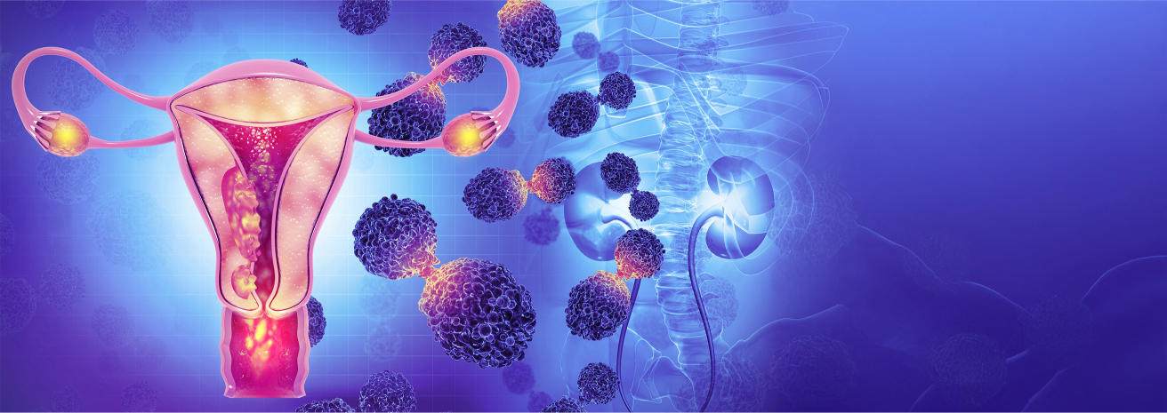 Cervical Cancer