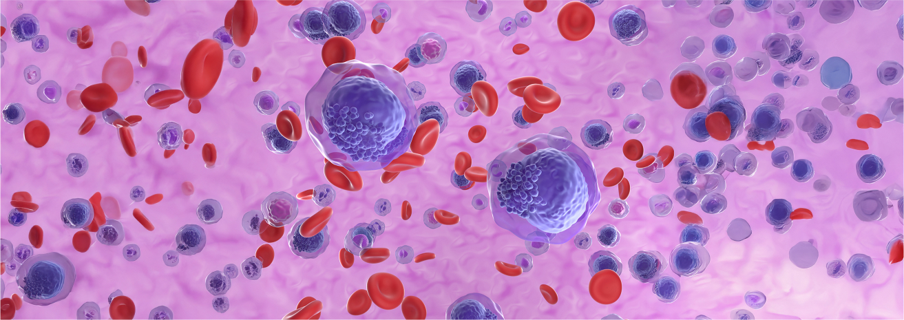 Risk Factors for leukemia include