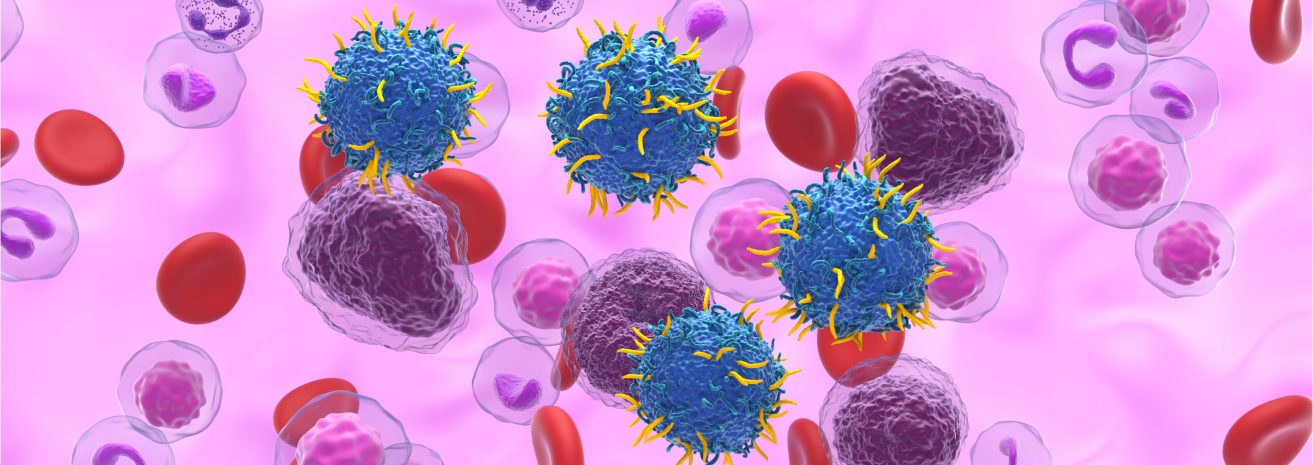 Risk Factors for lymphoma include
